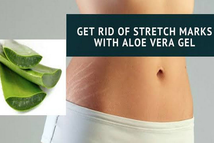 Useful Ways To Use Aloe Vera For Stretch Marks Hergamut